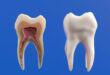 Home Remedies for Toothache