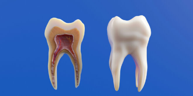 Home Remedies for Toothache