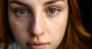Well Health Organic Best Ways to Remove Dark Spots on Face