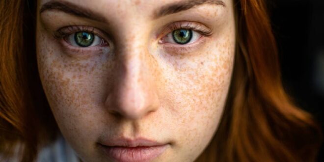 Well Health Organic Best Ways to Remove Dark Spots on Face